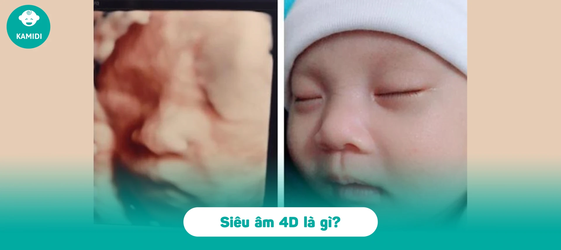 Chẩn đoán các dị tật bẩm sinh