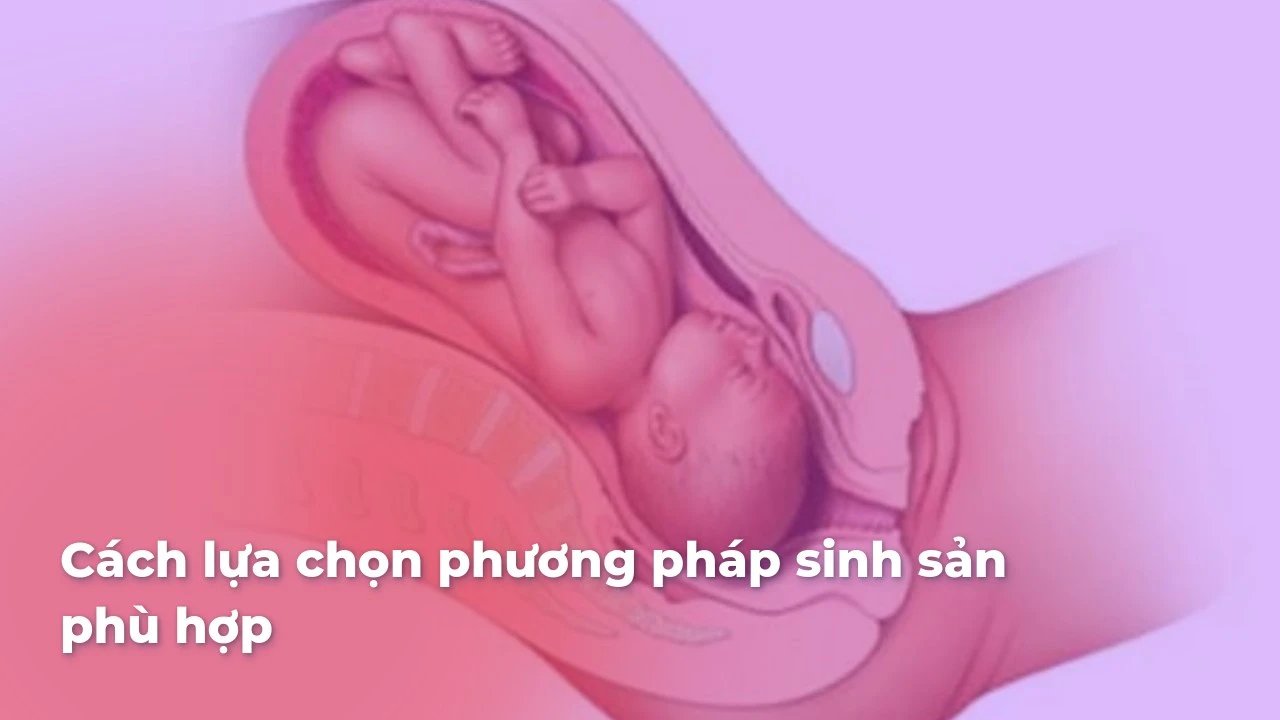 Cách lựa chọn phương pháp sinh sản phù hợp với các cặp đôi