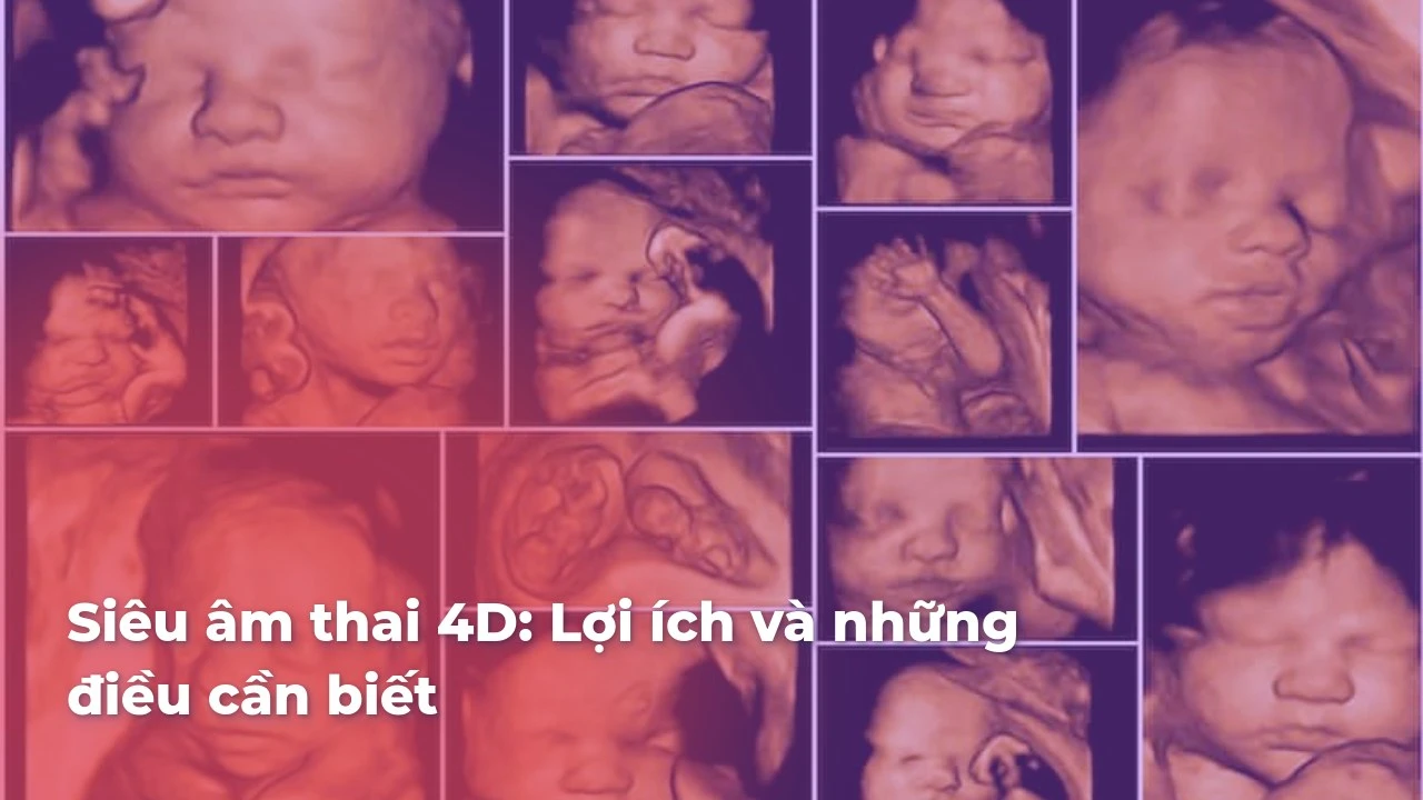 Siêu âm thai 4D: Lợi ích, quy trình và chi phí chi tiết