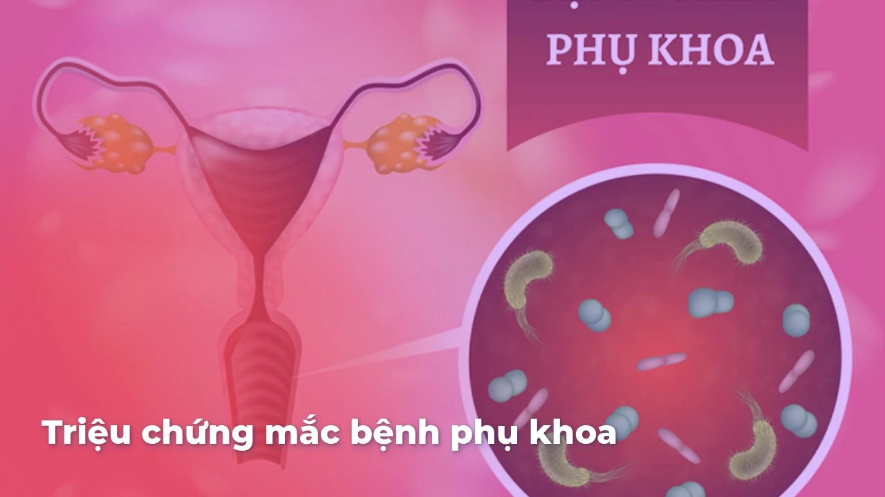 Triệu chứng mắc bệnh phụ khoa: Cách nhận biết và phòng ngừa hiệu quả